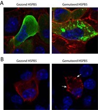 afbeelding van verschillende mutaties eiwit HSPB5